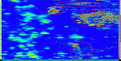 Abbildung 11: Außenkorrosion im C-Bild, mit dem HydroFORM Scanner erfasst