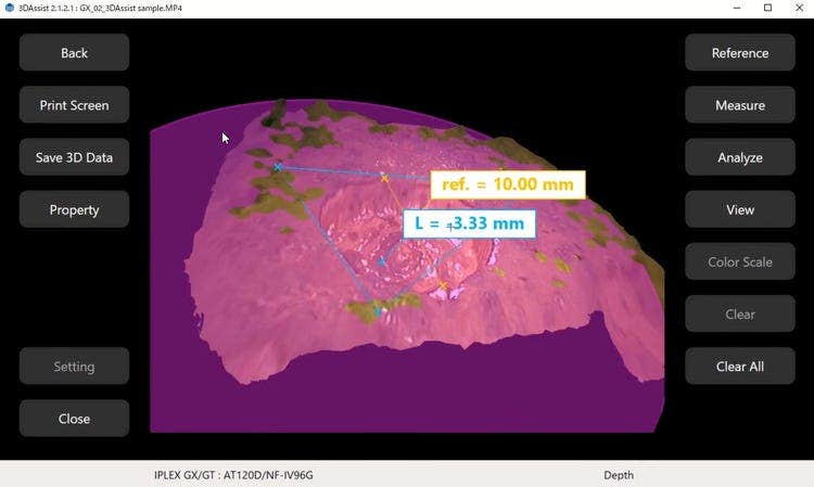 Gesteigerte Prüfpräzision mit integrierter 3D-Analyse
