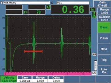 Conventional Ultrasound