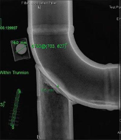 Radiograph of trunnion (Courtesy of ESR Technology)