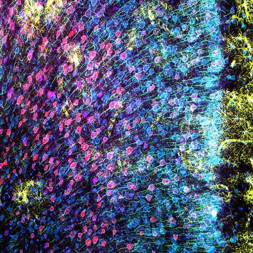 Figure 2: Mouse mPFC labeled with glial fibrillary acidic protein (GFAP; astrocyte marker; yellow), calmodulin-dependent protein kinase II (CaMKII; pyramidal neuron marker; red), amphoterin-induced protein 1 precursor (AMIGO-1; neuronal membrane marker; cyan), parvalbumin (PV; inhibitory neuron marker; purple), ankyrin-G (AnkG; axon initial segment marker; green), and nuclear yellow (nuclei marker; blue).