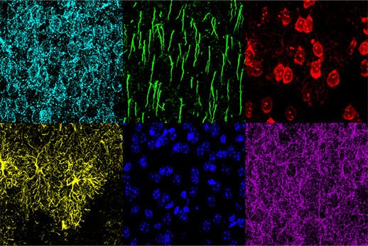 Figure 3: Mouse mPFC labeled with glial fibrillary acidic protein (GFAP; astrocyte marker; yellow), calmodulin-dependent protein kinase II (CaMKII; pyramidal neuron marker; red), amphoterin-induced protein 1 precursor (AMIGO-1; neuronal membrane marker; cyan), parvalbumin (PV; inhibitory neuron marker; purple), ankyrin-G (AnkG; axon initial segment marker; green), and nuclear yellow (nuclei marker; blue). (A) Individual channels of the six fluorophores. (B) Overlay image.