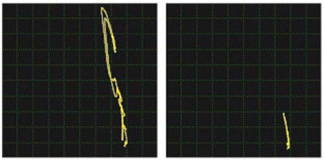 Comparison of a crack signal to a defect-free area using a weld probe