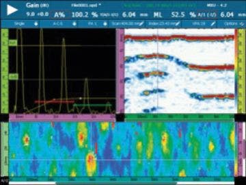 Phased Array Ultrasound