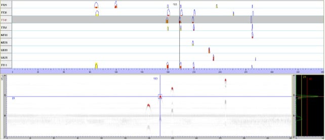 Screen shot of a data display including A-scan and B-scan results for an ultrasonic inspection of a train wheelset