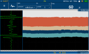 A/B-scan of an automotive paint thickness measurement