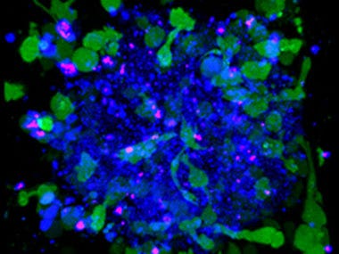 Application note: Neurovascular Structure