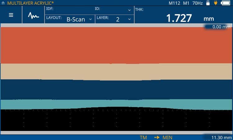 B-Scan: Ultrasonic b-scan