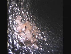 [Remnants of sand detected by videoscope inspection]