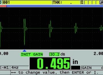 Conventional Ultrasound