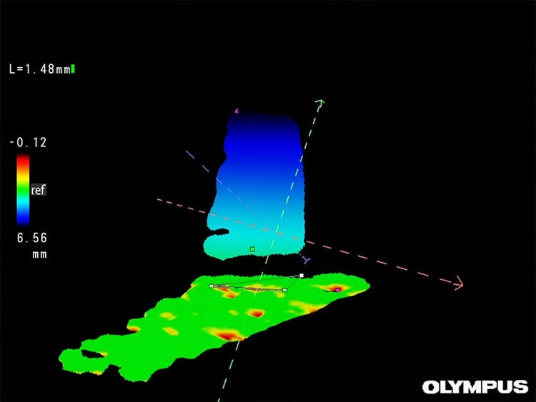 Inspección visual con una cámara videoscópica