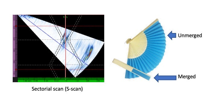 Ilustración para explicar cómo funciona el B-scan combinado