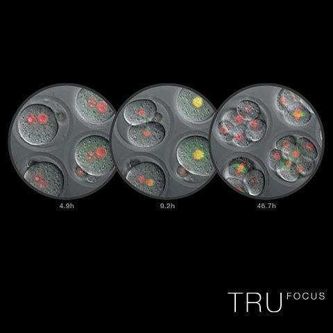 TruFocus