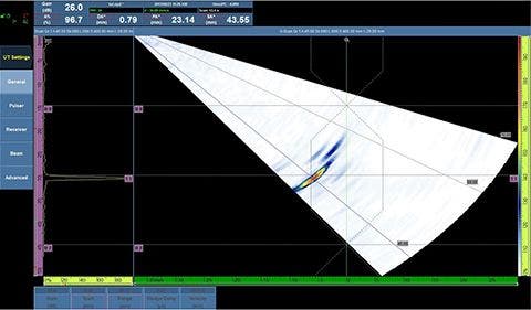 Representaciones de ultrasonido multielemento (Phased Array)