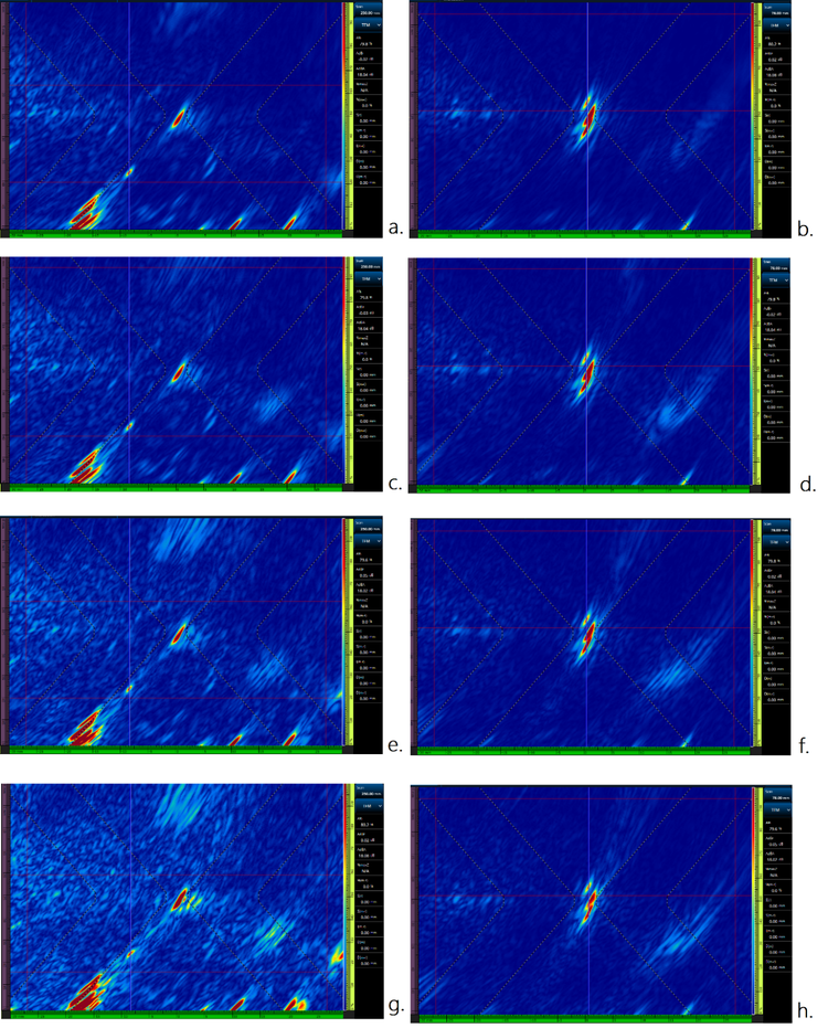 Vitesse de balayage maximale sous PWI/TFM avec un pas angulaire de 1° : 38 mm/s (a et b) ; vitesse de balayage sous PWI/TFM avec un pas angulaire de 2° : 73 mm/s (c et d) ; vitesse de balayage sous PWI/TFM avec un pas angulaire de 3° : 106 mm/s (e et f) ; vitesse de balayage sous PWI/TFM avec un pas angulaire de 5° : 167 mm/s (g et h)