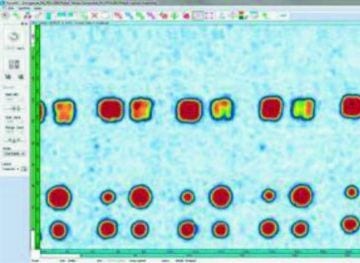 Phased Array Ultrasound