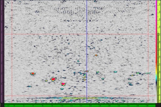 PWI/PCIの角度ステップ5°の最大スキャン速度： 204 mm/s
