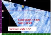 Detection of the SDH: T/4