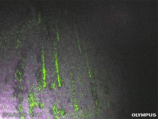 자외선(UV)을 이용한 잔여물 투과