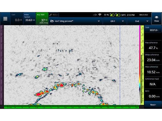 위상 일관성 이미징(PCI)