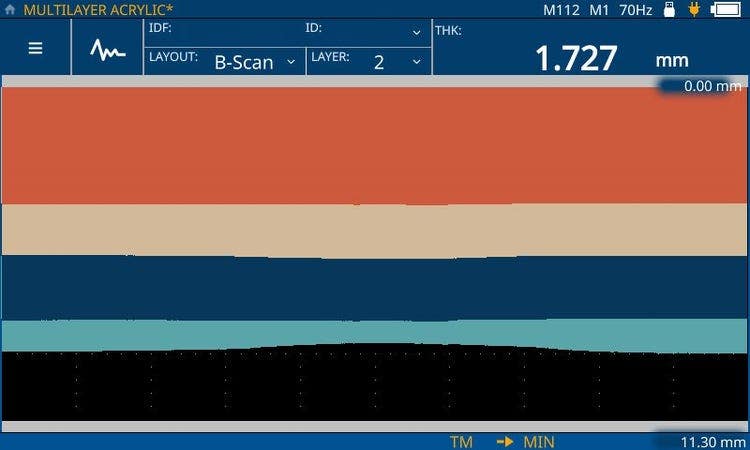 B-Scan: Ultrasonic b-scan