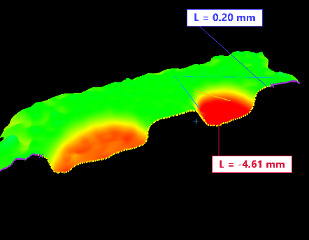 盲孔的横截面图。