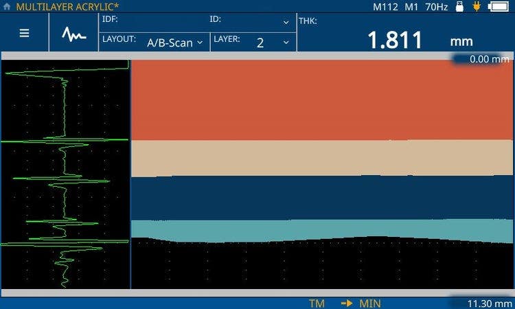 Ultrasonic a-scan b-scan